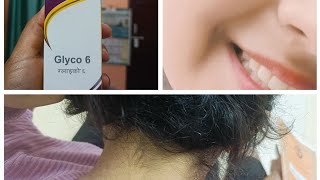 Benefits of glycolic acid cream How to use glycolic acid cream ytshorts ytshorts instagram [upl. by Jemina]