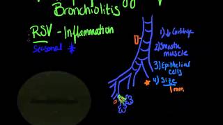 bronchiolitis pathophysiology clayton and berro [upl. by Charmine]