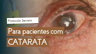 Como ter uma BOA RECUPERAÇÃO após a cirurgia de CATARATA  Emmerson Badaró [upl. by Ajiat861]