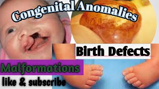 Basics of Congenital Anomalies Birth Defects Malformations [upl. by Gyimah]