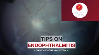 Tips on Endophthalmitis [upl. by Prud]