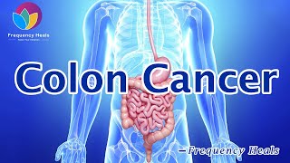 Sound Treatment for Colon Cancer  Healing Frequencies  Frequency Heals [upl. by Esserac]