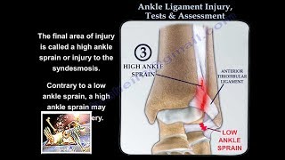 Ankle Ligament Injury evaluation and tests  Everything You Need To Know  Dr Nabil Ebraheim [upl. by Aicat845]