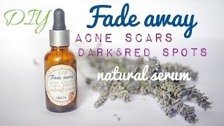 DIY Acne Scar Removal Serum amp Rosacea Natural Treatment with Rosehip amp Black Seed Oil [upl. by Nicholas]