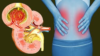 Nephritis Causes And Treatment [upl. by Brindell500]