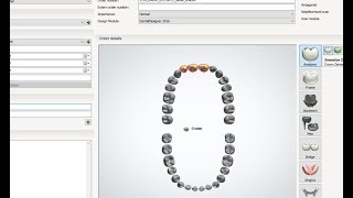 how you can create order and change settings with 3shape dental system part 1 [upl. by Alex]