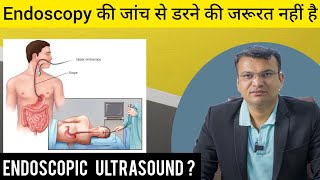 कब पड़ती है मरीज को एंडोस्कोपी टेस्ट की जरूरत   Endoscopy की जांच से डरने की जरूरत नहीं है [upl. by Aihselat]