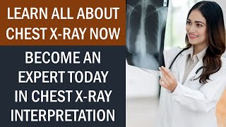 Learn Everything About Chest Xray Now  Become An Expert in CXR Interpretation [upl. by Brod417]