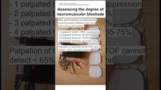 Assessing the degree of neuromuscular blockade [upl. by O'Doneven118]