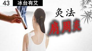 艾灸养生43 肩周炎胳膊疼该怎么办？还在吃止痛药？一个解决肩周炎五十肩不用打针吃药的方法，艾灸帮你摆脱你的肩周炎。Periarthritis of the shoulder treatment [upl. by Harat979]