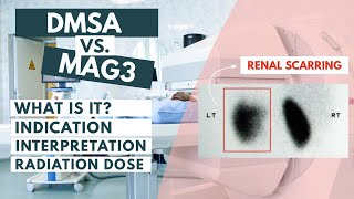 DMSA vs MAG3 scan  Nuclear Medicine  Indepth review [upl. by Carry155]