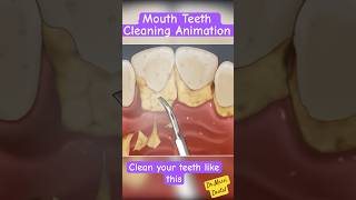 Teeth Cleaning Scaling Animation [upl. by Ajet68]