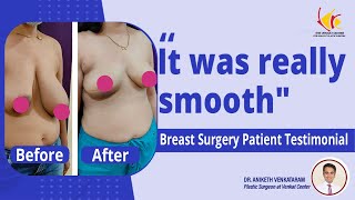 Breast Reduction Surgery Review  Breast Surgery in India  Venkat Center [upl. by Eyahc750]