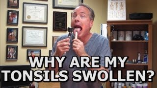 Natural Solutions For Swollen Tonsils How To Avoid A Tonsillectomy Common Sense Medicine [upl. by Yaner]