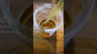 Urine under the microscope [upl. by Deraj]