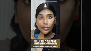 Full Face Sculpting amp Depigmentation at Sarayu Clinics beauty skincare [upl. by Veno]