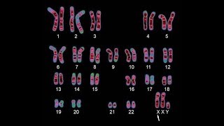 Human Genetics  Karyotyping [upl. by Ysiad]