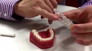 Sharp edges with your Invisalign plates how and what to do Dr Andrew Chang Smiles amp Faces Ortho [upl. by Zingale]