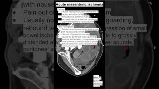 Acute mesenteric ischemia [upl. by Ennovi]