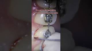 odontologia dentista dentistica dentist dentes dentistry dentistasp dentistaporto bracket [upl. by Neroled]