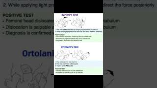 barlows and Ortolani Tests [upl. by Maletta94]