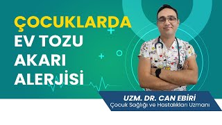 Çocuklarda Ev Tozu Akarı Alerjisi  Uzm Dr Can Ebiri [upl. by Rehctaht404]