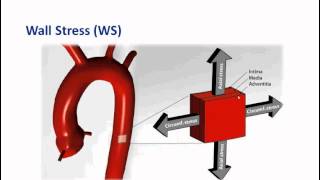 Biomechanical AAA Risk Assessment Part 3  Basic introduction to vascular biomechanics and BMRRA [upl. by Aracal150]