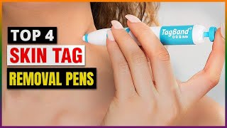 Best Skin Tag Removal Pens 2024  Top 4 Picks [upl. by Ynahpets125]