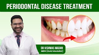 Periodontal Disease Treatment  GUM Disease  What is the Best Treatment for Periodontal Disease [upl. by Intisar]