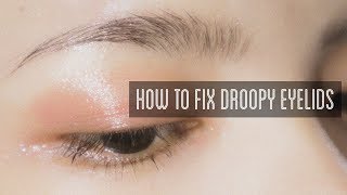 How to Fix Droopy Eyelids [upl. by Annaoi842]