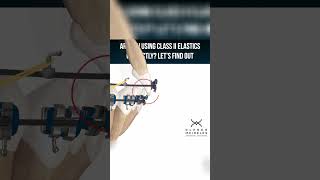 ARE YOU USING CLASS II ELASTICS CORRECTLY   ORTHODONTIC TIPS Shorts [upl. by Finbur]