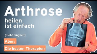 Arthrose verstehen und behandeln Schmerzfreiheit trotz Arthrose – Die besten Therapieansätze [upl. by Ynnahc]