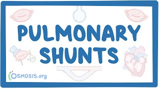 Pulmonary shunts [upl. by Lasyrc]