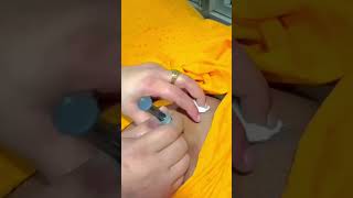 Inject in the Buttocks  Injection Tips for Beginners [upl. by Hartzke303]