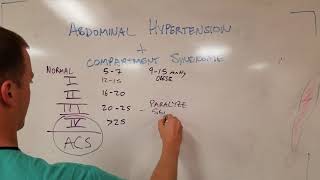 Dangerous and Deadly  Abdominal Compartment Syndrome [upl. by Garvey]