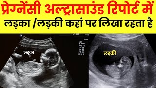 Pregnancy ultrasound se kaise pata krein ki ladka hai ya ladki [upl. by Nemrac]