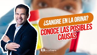 Sangre en la Orina Conoce sus causas [upl. by Llehcal]