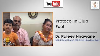 Importance Of Splint Protocol In Club Foot [upl. by Julina]