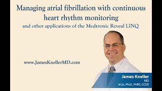 Management of atrial fibrillation guided by the Medtronic Reveal LINQ [upl. by Eentrok]