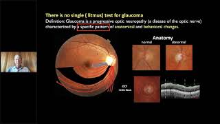 Recorded Webinar An OCT Approach to Understanding amp Diagnosing Glaucomatous Damage [upl. by Radloff]