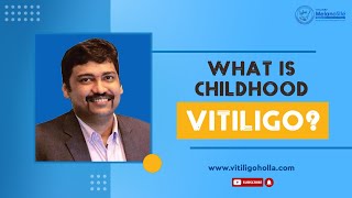 Childhood Vitiligo  Effects on children and treatment options  Dr A P Holla  MelanoSite [upl. by Say]