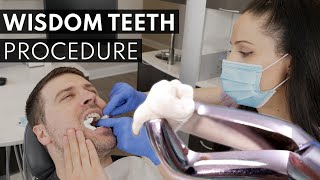 Wisdom Teeth Extraction PROCEDURE  How to Prepare What to Expect amp Cost [upl. by Nebur782]