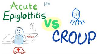 Acute Epiglottitis Vs Croup  A Detailed Comparison [upl. by Lyj654]