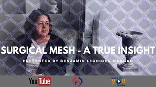 What is Surgical Mesh and what is it used for  A true Insight [upl. by Althea]