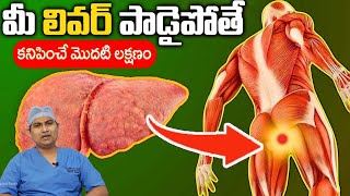 10 Symptoms of Liver Problem  Fatty Liver Symptoms  liver damage Sign  Dr Sachin Daga [upl. by Mitchell640]