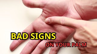 Do You Have These Bad Signs In Your Hand  Palmistry [upl. by Nylasoj]