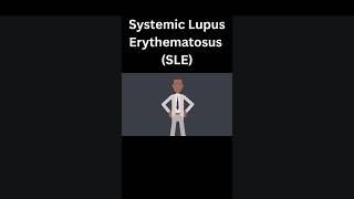 Systemic Lupus Erythematosus SLE [upl. by Veradis]