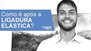 Como é após a ligadura elástica  Dr Marcelo Werneck [upl. by Eimmij918]