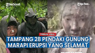 Kondisi Wajah dan Tubuh Pendaki Gunung Marapi Disorot 42 Pendaki Belum Diselamatkan [upl. by Ahsenat]