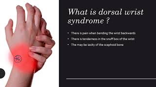 Dorsal Wrist Syndrome  Everything You Wanted to Know [upl. by Zilla685]